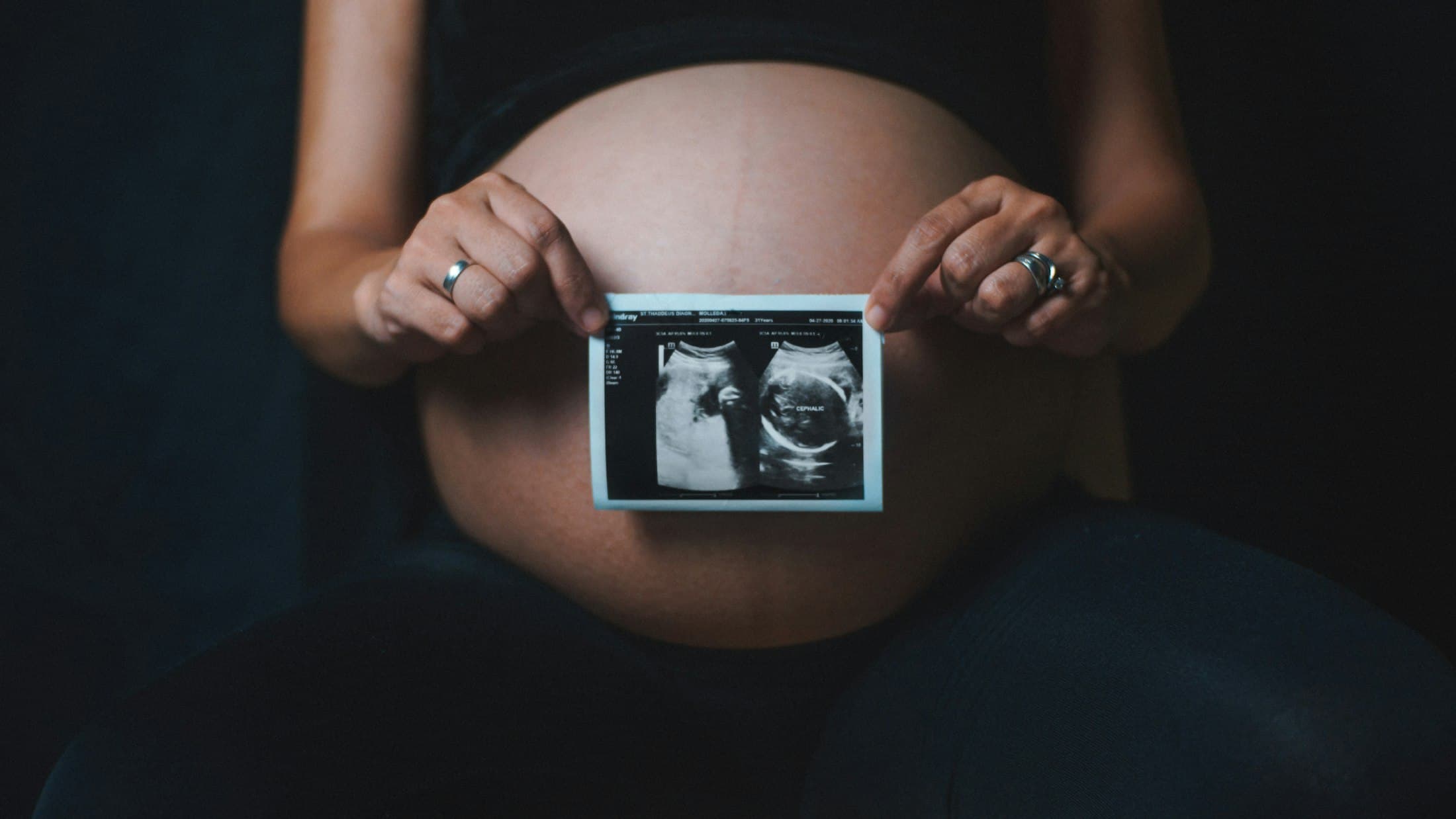 An ultrasound print held against a pregnant belly