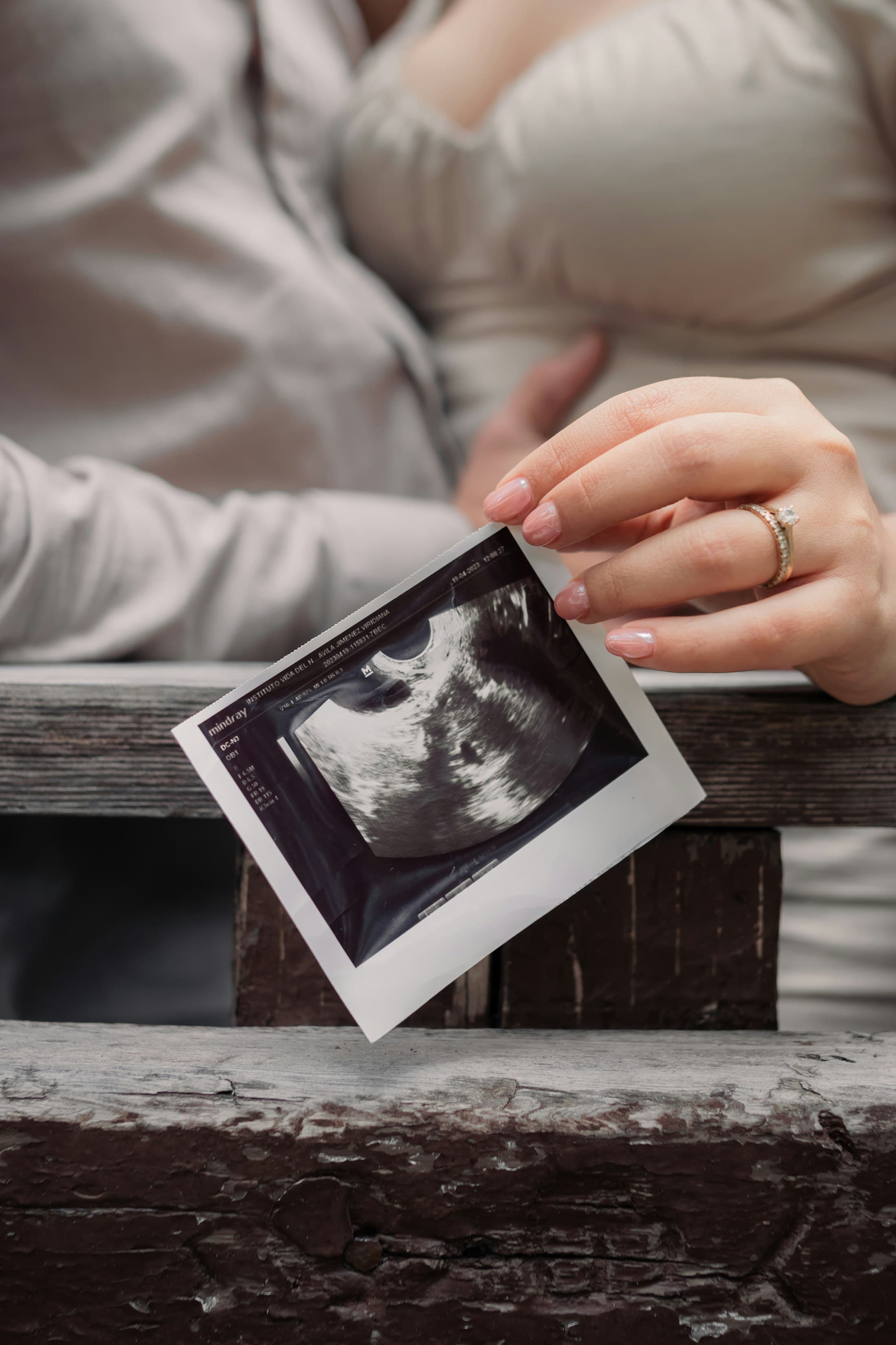 Hands holding an ultrasound print